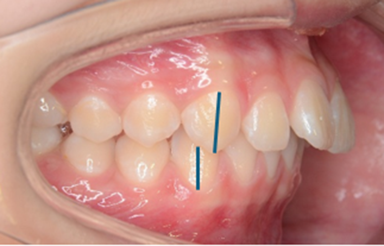 港区（三田・赤羽橋）の矯正歯科専門医院、矯正歯科クリニック三田赤羽橋