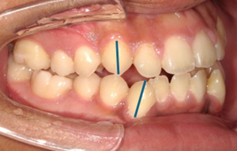 港区（三田・赤羽橋）の矯正歯科専門医院、矯正歯科クリニック三田赤羽橋