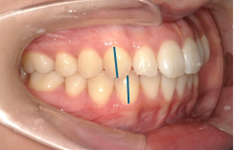 港区（三田・赤羽橋）の矯正歯科専門医院、矯正歯科クリニック三田赤羽橋