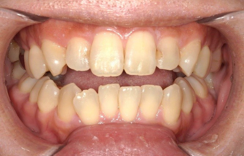 港区（三田・赤羽橋）の矯正歯科専門医院、矯正歯科クリニック三田赤羽橋