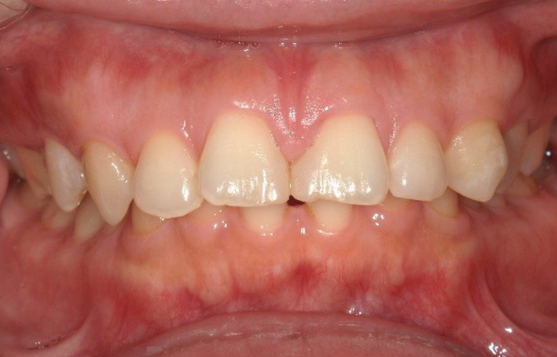 港区（三田・赤羽橋）の矯正歯科専門医院、矯正歯科クリニック三田赤羽橋