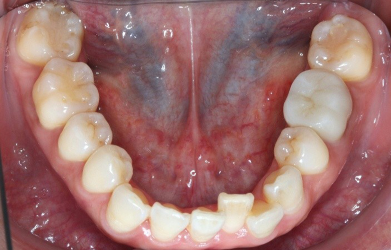 港区（三田・赤羽橋）の矯正歯科専門医院、矯正歯科クリニック三田赤羽橋