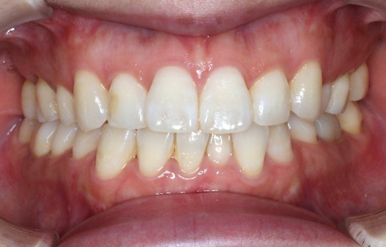 港区(三田・赤羽橋)の矯正歯科専門医院、矯正歯科クリニック三田赤羽橋