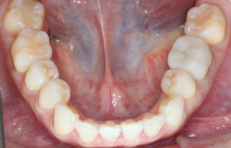 港区（三田・赤羽橋）の矯正歯科専門医院、矯正歯科クリニック三田赤羽橋