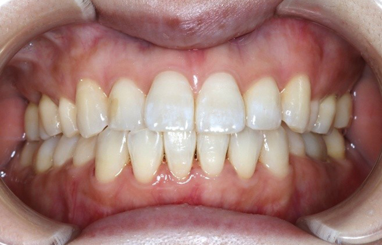 港区(三田・赤羽橋)の矯正歯科専門医院、矯正歯科クリニック三田赤羽橋