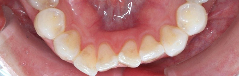 港区（三田・赤羽橋）の矯正歯科専門医院、矯正歯科クリニック三田赤羽橋