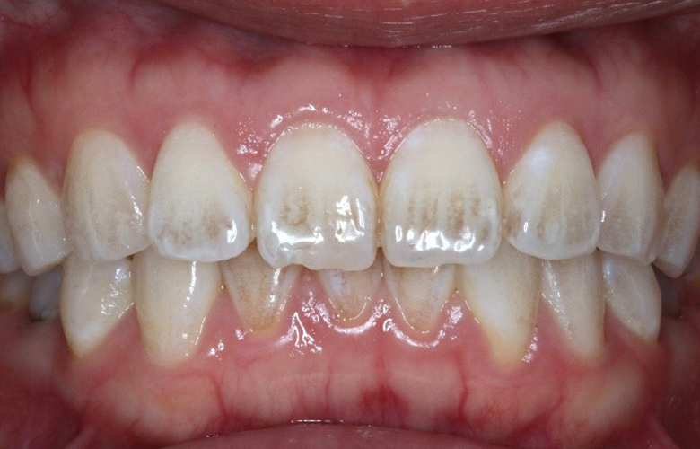 港区(三田・赤羽橋)の矯正歯科専門医院、矯正歯科クリニック三田赤羽橋