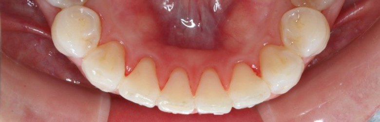 港区（三田・赤羽橋）の矯正歯科専門医院、矯正歯科クリニック三田赤羽橋