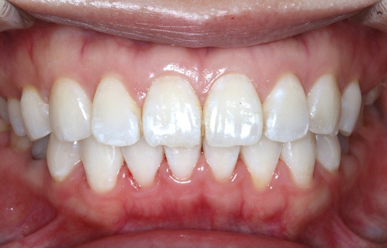 港区(三田・赤羽橋)の矯正歯科専門医院、矯正歯科クリニック三田赤羽橋