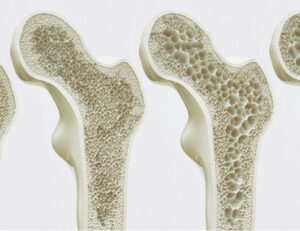 港区（三田・赤羽橋）の矯正歯科専門医院、矯正歯科クリニック三田赤羽橋で矯正治療でインプラント矯正について解説