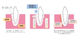 港区（三田・赤羽橋）の矯正歯科専門医院、矯正歯科クリニック三田赤羽橋で矯正治療で矯正中に歯がグラグラする原因について解説