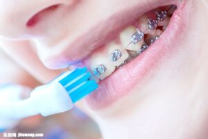 港区（三田・赤羽橋）の矯正歯科専門医院、矯正歯科クリニック三田赤羽橋で矯正治療中の歯根吸収のリスクと進行を防ぐ対策を解説