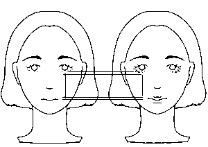 港区（三田・赤羽橋）の矯正歯科専門医院、矯正歯科クリニック三田赤羽橋で矯正治療で中顔面が長くなる？そういわれる原因や対処法を解説